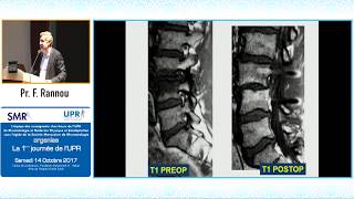 Finesses de lexamen clinique du rachis lombaire Pr F Rannou [upl. by Ahsiat]