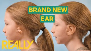 Doctors Gave This 10YearOld A LIFECHANGING Prosthetic Ear  The Face Doctors [upl. by Yerak]