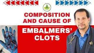 Embalmers Clots EXPOSED Whats Really Causing Them [upl. by Ithsav]