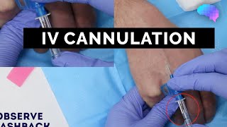 Intravenous IV cannulation  OSCE Guide  UKMLA  CPSA [upl. by Maloney]