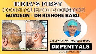 Occipital knob reduction in India  occipital surgery by dr Pentyala’s drpentyalas occipitallift [upl. by Sells]