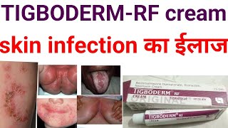 Tigoderm rf creambeclomethasone dipropionate econazole neomycin cream uses benifits in hindizolef [upl. by Ratep41]