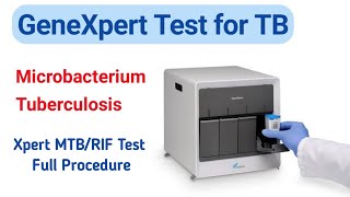 GeneXpert Test for TB  Full Procedure  Xpert MTBRIF Test  Creative Zone Plus [upl. by Hannaj]