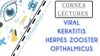 CORNEA LECTURE 10 VIRAL KERATITIS HERPES ZOOSTER OPTHALMICUS [upl. by Manny969]