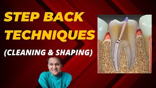 step back technique  root canal procedure  what is Recapitulation [upl. by Beckett]