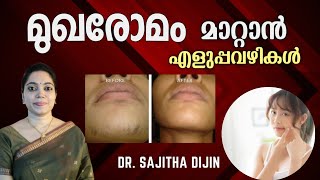 മുഖരോമം വരുമെന്ന പേടി വേണ്ടFacial Hair Removal EasyampSafe Methods at HomeAyurcharya [upl. by Cutcheon]