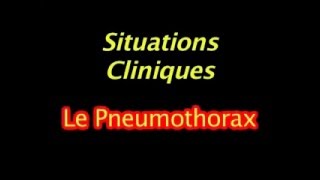 Echographie pleuropulmonaire en réanimation [upl. by Alvin682]