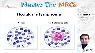 MTM Endocrine Surgery P3 Voice Shots Dr Bishoy 92021 SIADH Parathyroid amp Thyroid [upl. by Ylrebmic739]