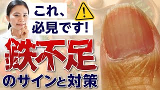 【不調の9割】鉄不足のサイン・お肉・サプリを摂っても治らない理由は〇〇です [upl. by Norad]