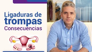 Consecuencias de la ligadura de trompas l Dr Juan Luis Giraldo [upl. by Narine]