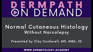 Normal Cutaneous Histology  Without Narcolepsy [upl. by Kiel]