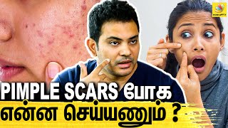 Pimpleஅ Remove Panalama   Dr Sethuraman Interview About Pimple Removing Tips amp Treatment [upl. by Moretta]