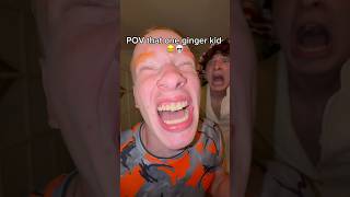 Bro is allergic to the sun 😂💀 funny comedy ginger viral youtubeshorts shorts trending [upl. by Reifel]