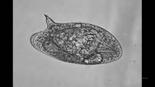 Schistosoma mansoni egg demonstration Marwa Omar [upl. by Lhok]