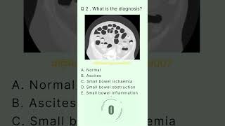 Abdomen Buzz 2 radiologychannel007 [upl. by Ayikat]