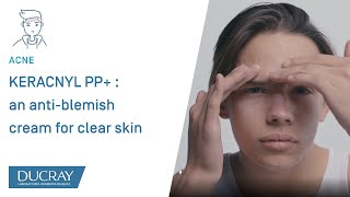 KERACNYL PP  an antiblemish cream for clear skin [upl. by Scevor]