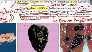 Biliary Atresia Cholelithiasis from first aid step 1USMLEUrduHindi [upl. by Esma]