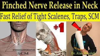 Wicked Neck Stretch for Fast Relief of Tight SCM Trap Scalene amp Pinched Nerve  Dr Mandell DC [upl. by Codee]