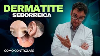 Como controlar a Dermatite Seborreica [upl. by Lyrrehs655]