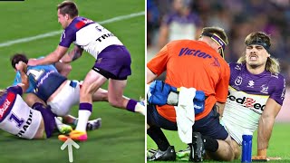 Ryan Papenhuyzen injury The fullback for the Melbourne Storm has an ankle problem [upl. by Weisbrodt]