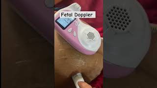 Fetal Doppler babyvideobaby [upl. by Hagen]