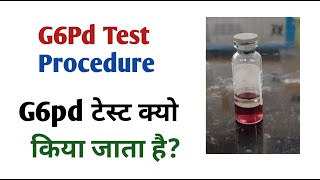 what is g6pd I g6pd test in hindi I g6pd test [upl. by Louis638]