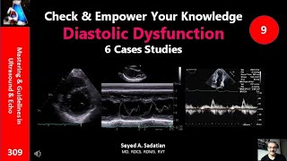 Check amp Empower Your Knowldge 9 Diastolic Dysfunction  6 case studies [upl. by Eicarg339]