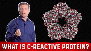 What is CReactive Protein amp How to Lower it – Dr Berg [upl. by Melville]