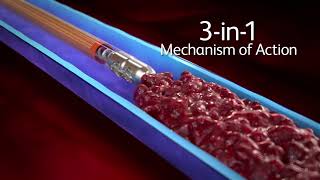 Aspirex™ Thrombectomy System 3in1 Mechanism of Action [upl. by Ayatnahs]