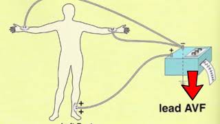 🔴 LES 12 DÉRIVATIONS ECG EXPLIQUÉES TRÈS CLAIREMENT  DR ASTUCE [upl. by Nahraf]