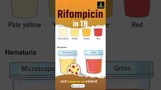 What is Rifampicin  Rifampicin in TB rifampicin nursing testpaperlivenursing shortvideo aiims [upl. by Sollows]