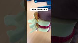 SPINAL DISCS DON’T SLIP shorts backpain lowerbackpain slippeddisc [upl. by Utter]