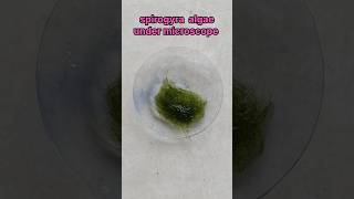 spirogyra algae under microscope experiment shorts biology scienceexperiment [upl. by Grenier221]