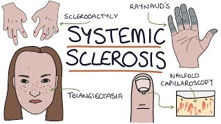 Systemic Sclerosis and Scleroderma Visual Explanation for Students [upl. by Anelrac]