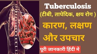 Tuberculosis टीबी तापेदिक क्षय रोग  क्यों होता है कारण लक्षण और बचाव   In hindi [upl. by Sadoff556]