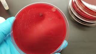 Microbiology Oxidase Test [upl. by Fidel]