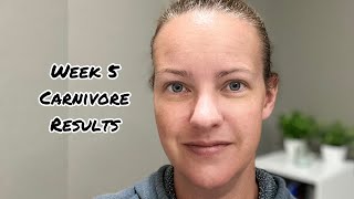 Carnivore Diet Week 5 Results [upl. by Magda]