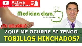 TOBILLOS HINCHADOS Dolor en los Tobillos Causas y soluciones  Medicina Clara [upl. by Levison652]