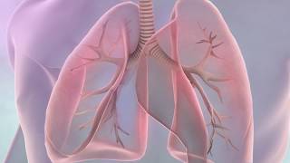 Symptoms of lung cancer [upl. by Cul]