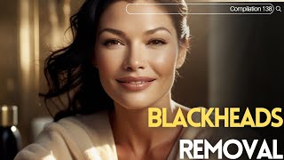 Skincare  Blackheads Removal 138 skincare skincare blackheads blackheads [upl. by Beatty]