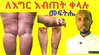 የእግር እብጠት ቀላል ተፈጥሮአዊ መፍትሄዎች Leg swelling and Edema Causes and Natural Treatments [upl. by Africa]