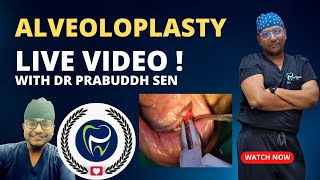 Dr Rudra Mohan  ALVEOLOPLASTY PROCEDURE LIVE  Preprosthetic Surgery  Smoothening Rough Jaw Bone [upl. by Whallon]