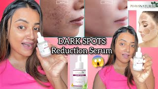 7Days Natural Serum for Pigmentation amp Dark Spots Removal  7Days Natural [upl. by Radbourne]