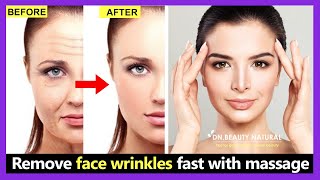 6 Mins Remove face wrinkles fast with massage Get tight smooth youthful face 100 effective [upl. by Robbins329]