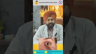 Welcome Dr Gurjeet Singh at Vasu Eye Institute and Skin Centre [upl. by Nicks]