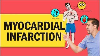 Myocardial Infarction Heart Attack for Nursing amp NCLEX [upl. by Everett]