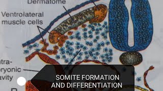 SOMITE DIFFERENTIATION [upl. by Dallman955]