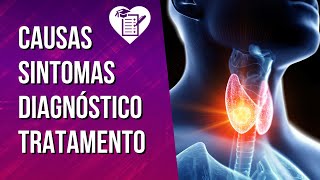 TIREOIDITE DE HASHIMOTO  Sintomas Fatores de Risco Diagnóstico e Tratamento [upl. by Neeham189]