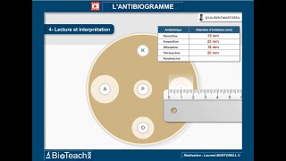 Tout savoir et comprendre sur lantibiogramme → Version courte← [upl. by Lleuqram948]