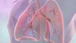 Treatments for lung cancer  Cancer Research UK [upl. by Simonsen]